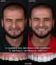 Slider image (7) Odontologia Laser